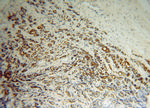 RAB3A Antibody in Immunohistochemistry (Paraffin) (IHC (P))