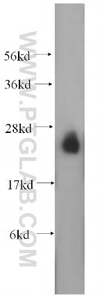 RAB3A Antibody in Western Blot (WB)