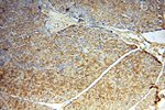 CUTC Antibody in Immunohistochemistry (Paraffin) (IHC (P))
