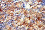 CUTC Antibody in Immunohistochemistry (Paraffin) (IHC (P))