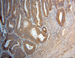 CUTC Antibody in Immunohistochemistry (Paraffin) (IHC (P))