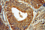 CUTC Antibody in Immunohistochemistry (Paraffin) (IHC (P))