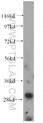 CUTC Antibody in Western Blot (WB)