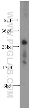 CUTC Antibody in Western Blot (WB)