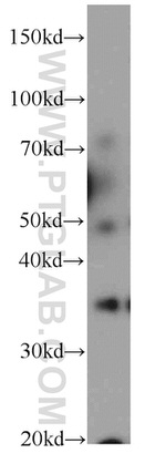 OSGEP Antibody in Western Blot (WB)