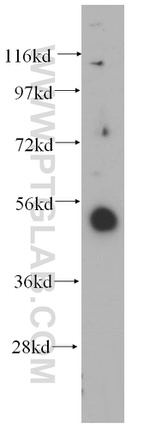 RING1 Antibody in Western Blot (WB)