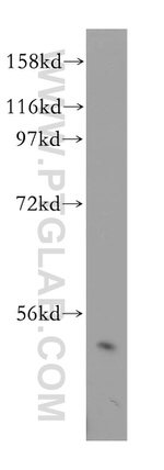 RING1 Antibody in Western Blot (WB)