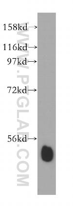 RING1 Antibody in Western Blot (WB)
