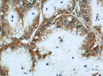 CMTM8 Antibody in Immunohistochemistry (Paraffin) (IHC (P))