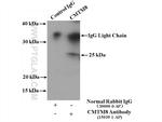 CMTM8 Antibody in Immunoprecipitation (IP)