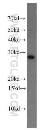 CMTM8 Antibody in Western Blot (WB)