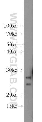 CMTM8 Antibody in Western Blot (WB)