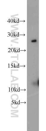 CMTM8 Antibody in Western Blot (WB)