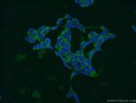 MRPL14 Antibody in Immunocytochemistry (ICC/IF)