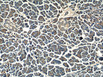 MRPL14 Antibody in Immunohistochemistry (Paraffin) (IHC (P))