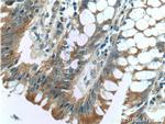 MRPL14 Antibody in Immunohistochemistry (Paraffin) (IHC (P))