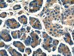 MRPL14 Antibody in Immunohistochemistry (Paraffin) (IHC (P))