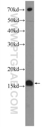 MRPL14 Antibody in Western Blot (WB)