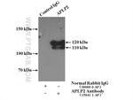 APLP2 Antibody in Immunoprecipitation (IP)