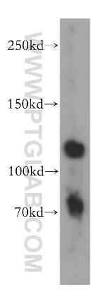 APLP2 Antibody in Western Blot (WB)
