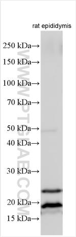 AP1S2 Antibody in Western Blot (WB)