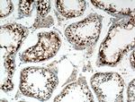 MAGEA8 Antibody in Immunohistochemistry (Paraffin) (IHC (P))
