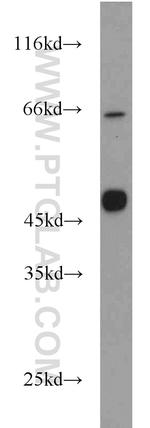 MAGEA8 Antibody in Western Blot (WB)