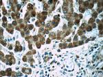 POMP Antibody in Immunohistochemistry (Paraffin) (IHC (P))