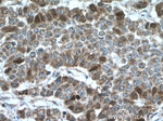 Thymidylate synthase Antibody in Immunohistochemistry (Paraffin) (IHC (P))