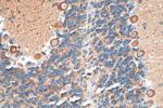 RTN1 (Isoform RTN1-C) Antibody in Immunohistochemistry (Paraffin) (IHC (P))