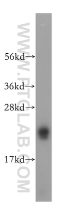RTN1 (Isoform RTN1-C) Antibody in Western Blot (WB)