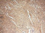 SMOX Antibody in Immunohistochemistry (Paraffin) (IHC (P))