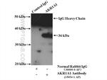 AKR1A1 Antibody in Immunoprecipitation (IP)