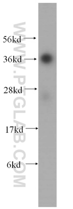 AKR1A1 Antibody in Western Blot (WB)