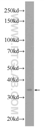 AKR1A1 Antibody in Western Blot (WB)