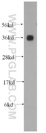AKR1A1 Antibody in Western Blot (WB)