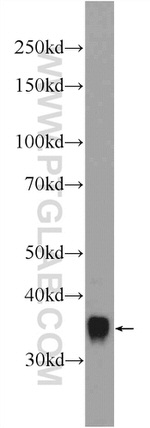 AKR1A1 Antibody in Western Blot (WB)
