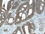 NUPR1 Antibody in Immunohistochemistry (Paraffin) (IHC (P))
