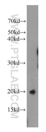 TPPP3 Antibody in Western Blot (WB)