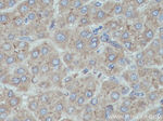 HPRT1 Antibody in Immunohistochemistry (Paraffin) (IHC (P))