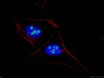 Nucleostemin Antibody in Immunocytochemistry (ICC/IF)