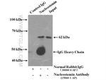 Nucleostemin Antibody in Immunoprecipitation (IP)
