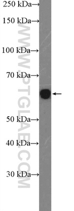 Nucleostemin Antibody in Western Blot (WB)
