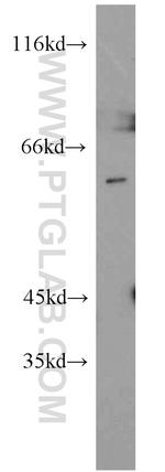 Nucleostemin Antibody in Western Blot (WB)
