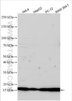 DHRS7 Antibody in Western Blot (WB)