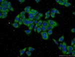 GSTT2 Antibody in Immunocytochemistry (ICC/IF)