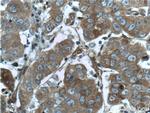 GSTT2 Antibody in Immunohistochemistry (Paraffin) (IHC (P))