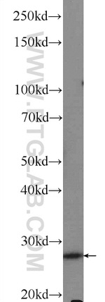 GSTT2 Antibody in Western Blot (WB)