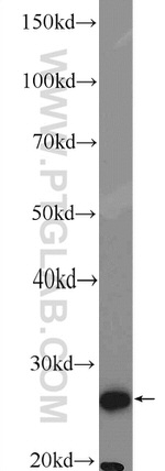 GSTT2 Antibody in Western Blot (WB)