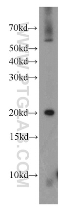NDUFA8 Antibody in Western Blot (WB)